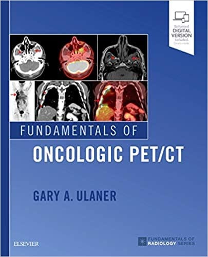 Fundamentals of Oncologic PET CT 2018 By Gary A. Ulaner