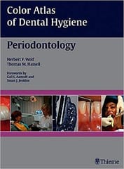 Color Atlas Of Dental Hygiene Periodontology By Wolf