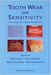 Tooth Wear And Sensitivity By Addy