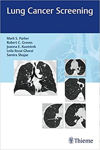 Lung Cancer Screening 1St Edition By Parker