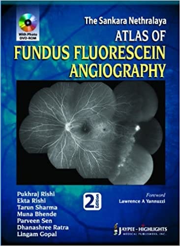 The Sankara Nethralaya Atlas Of Fundus Fluorescein Angiography With Photo Dvd-Rom 2nd Edition By Rishi Pukhraj