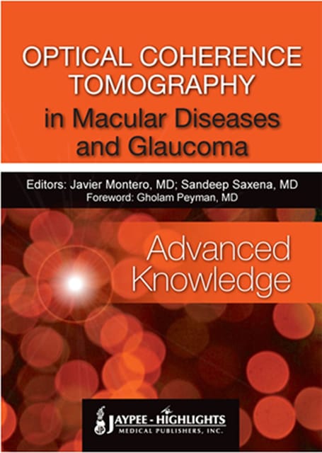 Optical Coherence Tomography In Macular Diseases And Glaucoma Advanced Knowledge 1st Edition By Saxena Montero