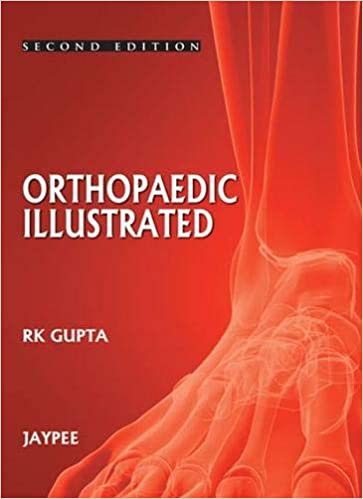 Orthopedics Illustrated 2nd Edition By Gupta Rk