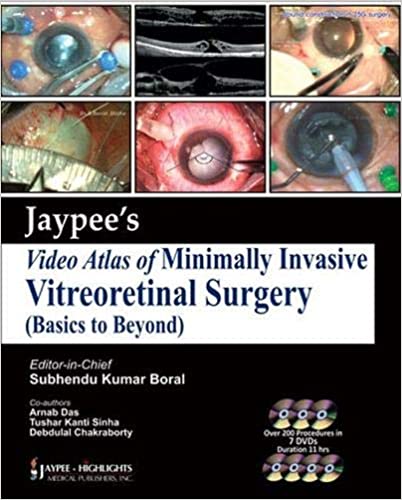 Jaypee Video Atlas Of Minimally Invasive Vitreoretinal Surgery 1st Edition By Boral