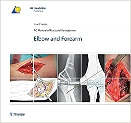 AO MANUAL OF FRACTURE MANAGEMENT ELBOW AND FOREARM 2009 By JUPITER