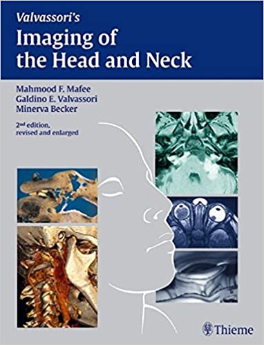 Imaging of the Head and Neck 2004 By Mafee
