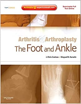 Arthritis & Arthroplasty: The Foot & Ankle With DVD 2010 By Coetzee Publisher Elsevier