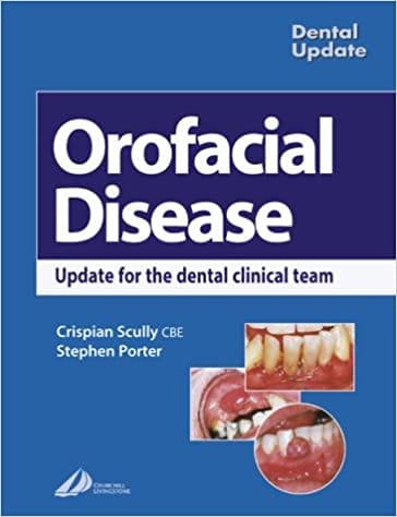 Orofacial Disease: Update for the Dental Clinical Team 2003 By Scully Publisher Elsevier