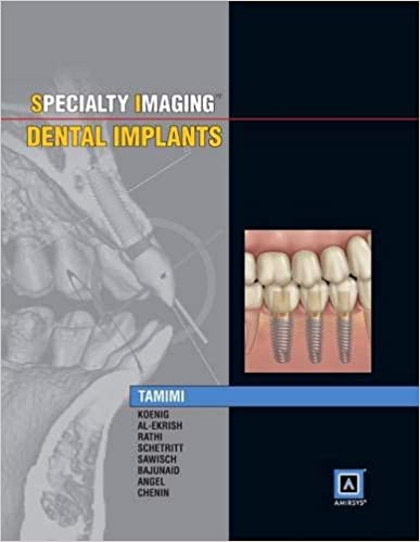 Specialty Imaging Dental Implants 2014 By Tamimi Publisher Elsevier