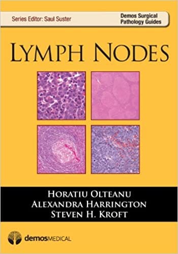 Lymph Nodes 2013 By Olteanu Publisher Demos Medical