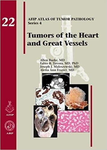 Tumors of the Heart and Great Vessels 22 2016 By Burke Publisher American Registry of Pathology
