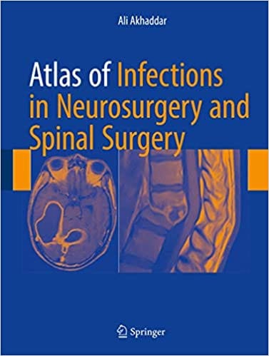 Atlas of Infections in Neurosurgery and Spinal Surgery 2017 By Akhaddar Publisher Springer