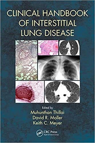 Clinical Handbook of Interstitial Lung Disease 2018 By Thillai Publisher Taylor & Francis