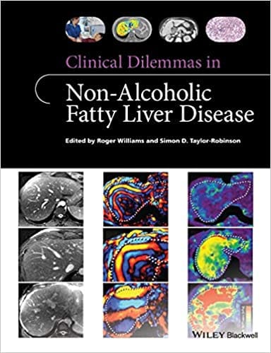 Clinical Dilemmas in Non Alcoholic Fatty Liver Disease 2016 By Williams Publisher Wiley