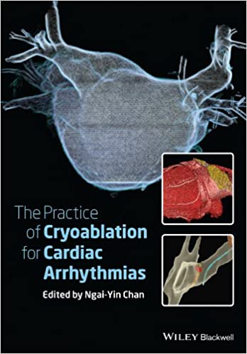 The Practice of Catheter Cryoablation for Cardiac Arrhythmias 2014 By Chan Publisher Wiley