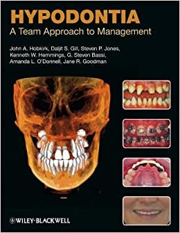 Hypodontia: A Team Approach to management 2011 By Hobkirk Publisher Wiley