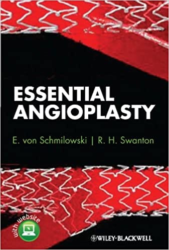 Essential Angioplasty 2012 By Schmilowski Publisher Wiley