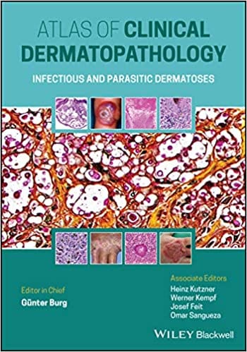 Atlas Of Clinical Dermatopathology Infectious And Parasitic Dermatoses 2021 By Burg G