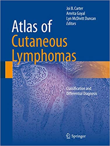 Atlas Of Cutaneous Lymphomas Classification And Differential Diagnosis 2015 By Carter J B