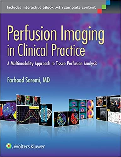 Perfusion Imaging In Clinical Practice A Multimodality Approach To Tissue Perfusion Analysis 2015 By Saremi F