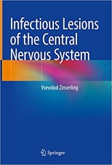 Infectious Lesions Of The Central Nervous System 2022 By Zinserling V