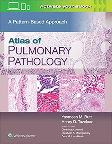 Butt Y M Atlas Of Pulmonary Pathology A Pattern Based Approach With Access Code 2021