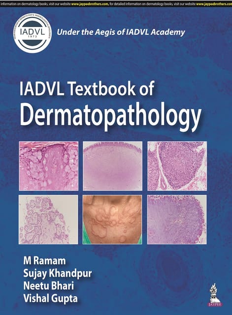 IADVL Textbook of Dermatopathology 1st Edition 2023 by M Ramam