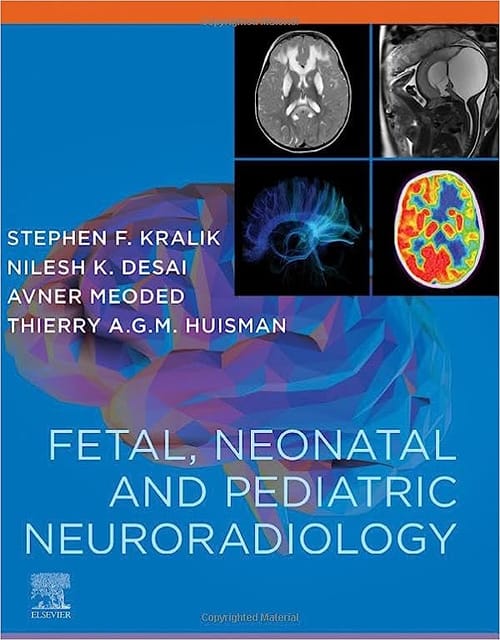 Fetal Neonatal And Pediatric Neuroradiology With Access Code 2024 By Kralik S F