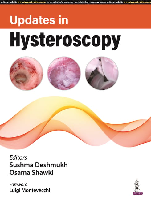 Updates in Hysteroscopy 1st Edition 2024 By Sushma Deshmukh