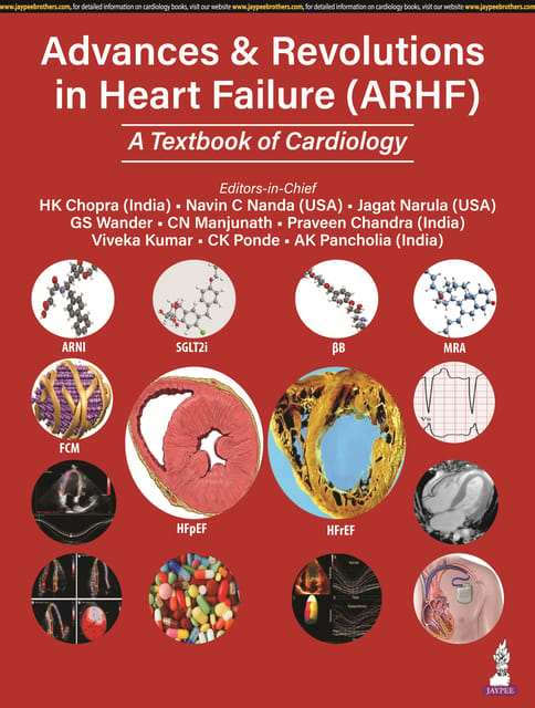 Advances & Revolutions In Heart Failure (Arhf) A Textbook Of Cardiology 2024 By Hk Chopra