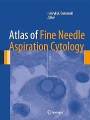 Atlas Of Fine Needle Aspiration Cytology 2014 By Domanski