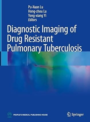 Diagnostic Imaging Of Drug Resistant Pulmonary Tuberculosis 2023 By Lu P.X.