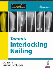 Tanna'S Interlocking Nailing 5th Edition 2024 By Dd Tanna