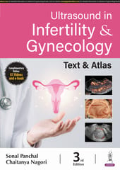 Ultrasound In Infertility & Gynecology Text & Atlas 3rd  Edition 2024 By Sonal Panchal