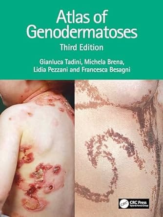 Atlas of Genodermatoses 3rd Edition 2024 By Gianluca Tadini