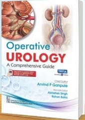 Operative Urology A Comprehensive Guide 1st Edition 2025 By Arvind P Ganpule