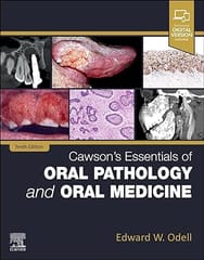 Cawsons Essentials Of Oral Pathology And Oral Medicine With Access Code 10th Edition 2025 By Odell E W