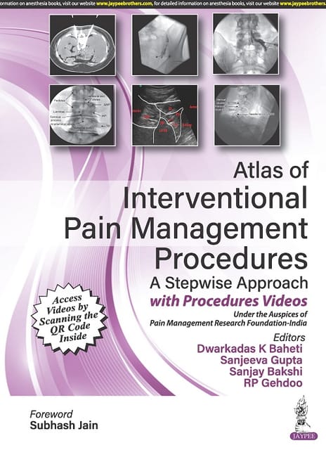 Atlas Of Interventional Pain Management Procedures: A Stepwise Approach 1st Edition 2023 By Dwarkadas K Baheti