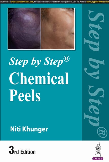 Step by Step Chemical Peels 3rd Edition 2024 By Niti Khunger