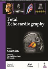 Fetal Echocardiography 2nd Edition 2024 By Sejal Shah