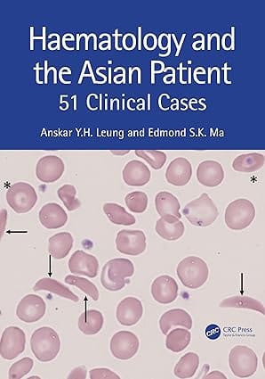 Haematology And The Asian Patient 51 Clinical Cases  2024 By Leung A Y H