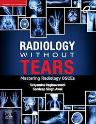 Radiology Without Tears Mastering Radiology OSCEs 1st Edition 2024 By Satyendra Raghuwanshi