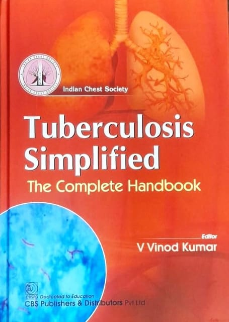 Tuberculosis Simplified The Complete Handbook 1st Edition 2024 By V Vinod Kumar