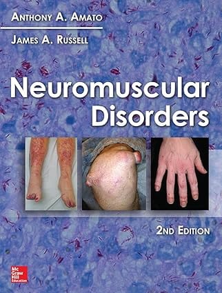 Neuromuscular Disorders 2nd Edition 2020 By Amato A A