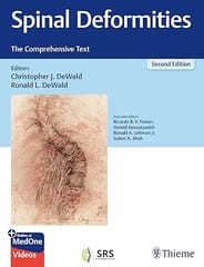 Spinal Deformities The Comprehensive Text 2nd Edition 2024 By Dewald