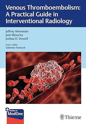 Venous Thromboembolism A Practical Guide in Interventional Radiology 1st Edition 2024 By Weinstein