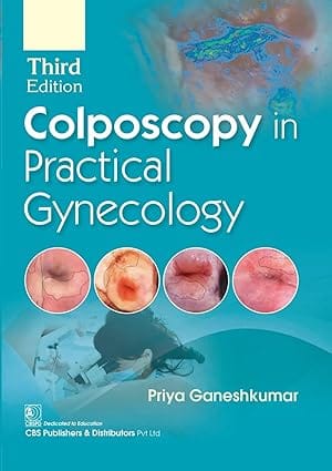 Colposcopy in Practical Gynecology 3rd Edition 2024 By Priya Ganeshkumar