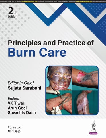 Principles And Practice Of Burn Care 2025 By Sujata Sarabahi