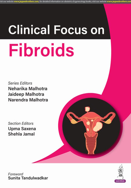 Clinical Focus On Fibroids 2025 By Neharika Malhotra