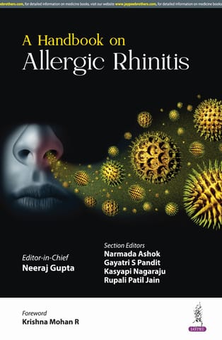 A Handbook On Allergic Rhinitis 1st Edition 2025 By Neeraj Gupta